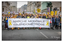 Worldwide endometriose